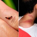 Don’t Ignore This! The Surprising Cause of Strange Debris in Your Drinking Water