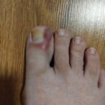 2 Weeks to a Flat Stomach with This Detox Drink Recipe!Full recipe